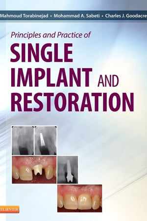 Principles and Practice of Single Implant and Restoration