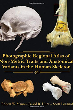 Photographic Regional Atlas of Non-Metric Traits and Anatomical Variants in the Human Skeleton