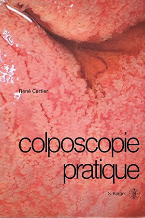 Colposcopie Pratique (French Edition)
