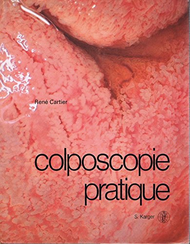 Colposcopie Pratique (French Edition)