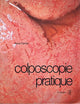 Colposcopie Pratique (French Edition)