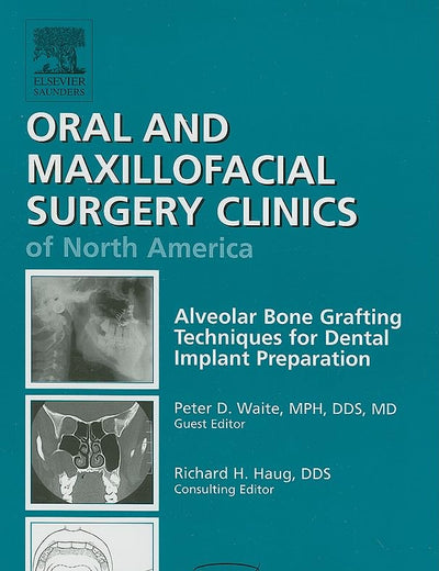 Alveolar Bone Grafting Techniques for Dental Implant Preparation, An Issue of Oral and Maxillofacial Surgery Clinics (Volume 22-3) (The Clinics: Dentistry, Volume 22-3)