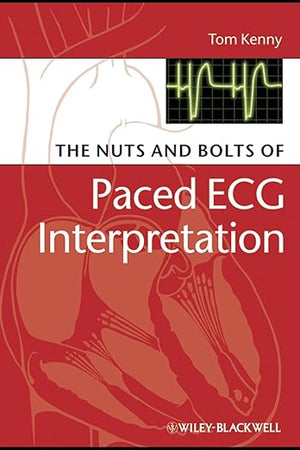 The Nuts and bolts of Paced ECG Interpretation (Nuts and Bolts Series (Replaced by 5113))