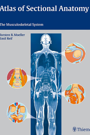 Atlas of Sectional Anatomy: The Musculoskeletal System