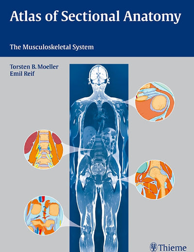Atlas of Sectional Anatomy: The Musculoskeletal System