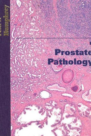 Prostate Pathology