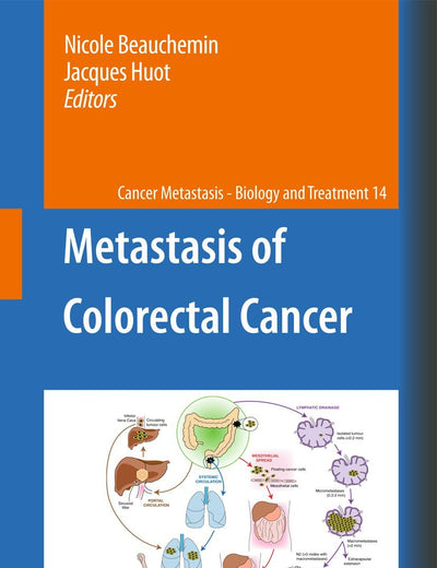 Metastasis of Colorectal Cancer (Cancer Metastasis - Biology and Treatment, 14)
