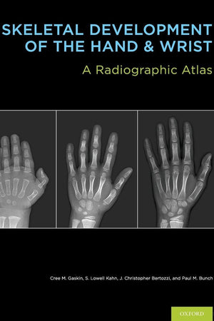 Skeletal Development of the Hand and Wrist: A Radiographic Atlas and Digital Bone Age Companion