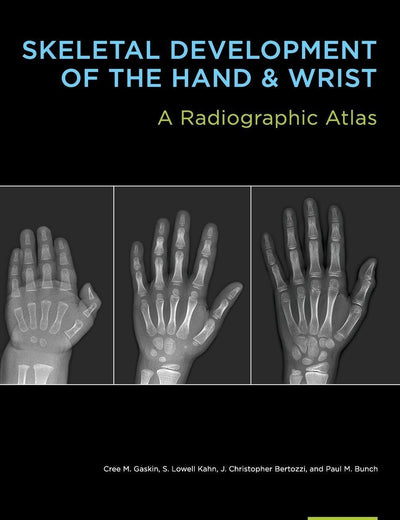 Skeletal Development of the Hand and Wrist: A Radiographic Atlas and Digital Bone Age Companion