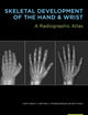 Skeletal Development of the Hand and Wrist: A Radiographic Atlas and Digital Bone Age Companion