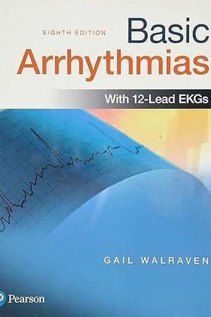 Basic Arrhythmias