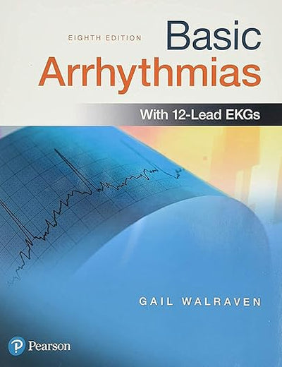 Basic Arrhythmias