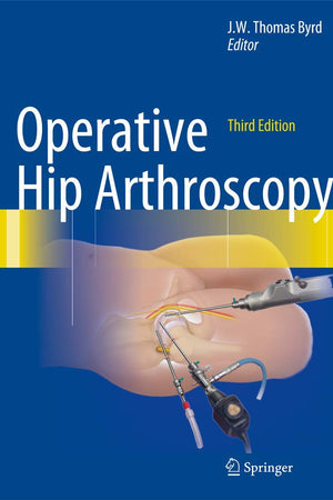 Operative Hip Arthroscopy
