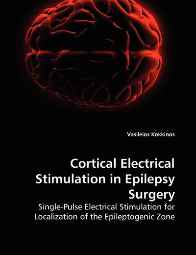Cortical Electrical Stimulation in Epilepsy Surgery: Single-Pulse Electrical Stimulation for Localization of the Epileptogenic Zone