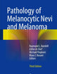 Pathology of Melanocytic Nevi and Melanoma