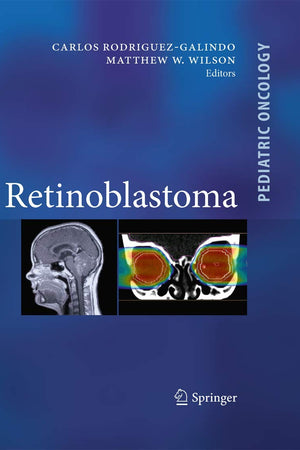 Retinoblastoma (Pediatric Oncology)