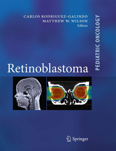 Retinoblastoma (Pediatric Oncology)