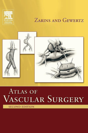 Atlas of Vascular Surgery - Paperback Edition