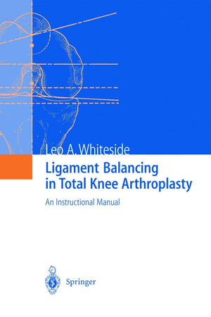 Ligament Balancing in Total Knee Arthroplasty: An Instructional Manual