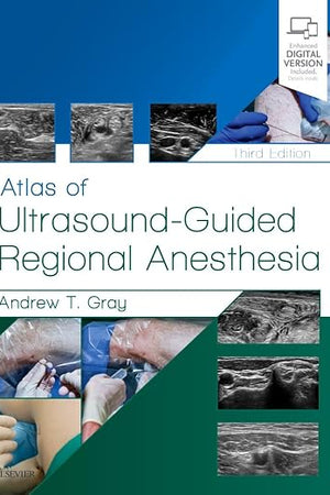 Atlas of Ultrasound-Guided Regional Anesthesia: Expert Consult - Online and Print