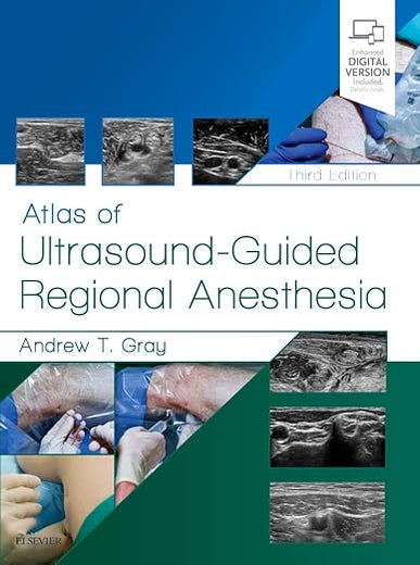 Atlas of Ultrasound-Guided Regional Anesthesia: Expert Consult - Online and Print