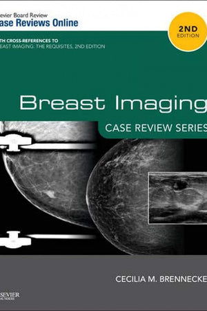 Breast Imaging: Case Review Series