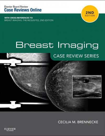 Breast Imaging: Case Review Series