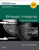 Breast Imaging: Case Review Series