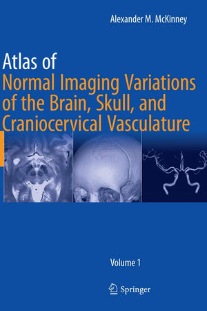 Atlas of Normal Imaging Variations of the Brain, Skull, and Craniocervical Vasculature