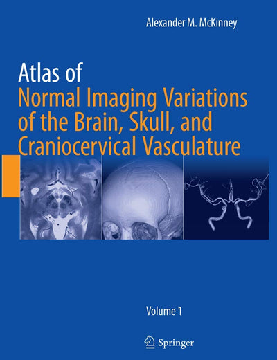 Atlas of Normal Imaging Variations of the Brain, Skull, and Craniocervical Vasculature