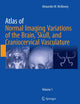 Atlas of Normal Imaging Variations of the Brain, Skull, and Craniocervical Vasculature