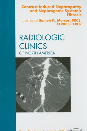 Contrast-Induced Nephropathy and Nephrogenic Systemic Fibrosis, An Issue of Radiologic Clinics of North America (Volume 47-5) (The Clinics: Radiology, Volume 47-5)