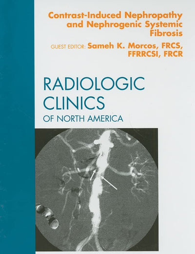 Contrast-Induced Nephropathy and Nephrogenic Systemic Fibrosis, An Issue of Radiologic Clinics of North America (Volume 47-5) (The Clinics: Radiology, Volume 47-5)