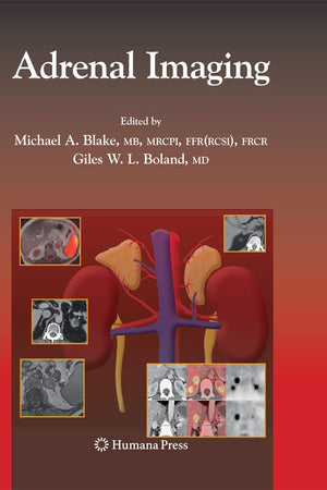 Adrenal Imaging (Contemporary Medical Imaging)
