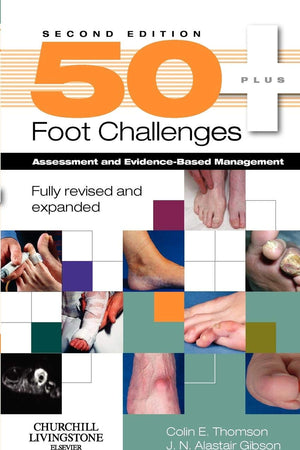 50+ Foot Challenges: Assessment and Evidence-Based Management
