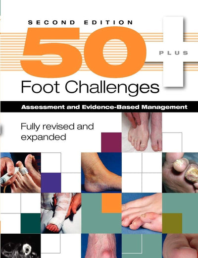 50+ Foot Challenges: Assessment and Evidence-Based Management