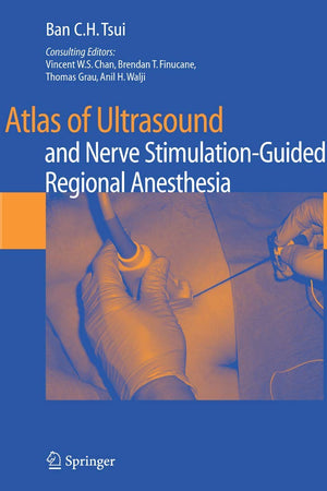 Atlas of Ultrasound- and Nerve Stimulation-Guided Regional Anesthesia