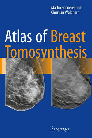 Atlas of Breast Tomosynthesis: Imaging Findings and Image-Guided Interventions