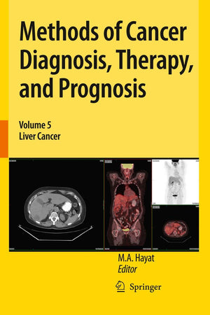 Methods of Cancer Diagnosis, Therapy, and Prognosis: Liver Cancer