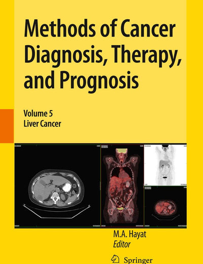 Methods of Cancer Diagnosis, Therapy, and Prognosis: Liver Cancer