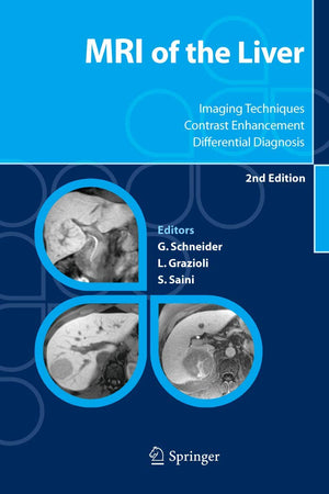 MRI of the Liver: Imaging Techniques, Contrast Enhancement, Differential Diagnosis