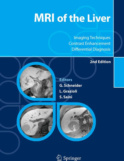 MRI of the Liver: Imaging Techniques, Contrast Enhancement, Differential Diagnosis
