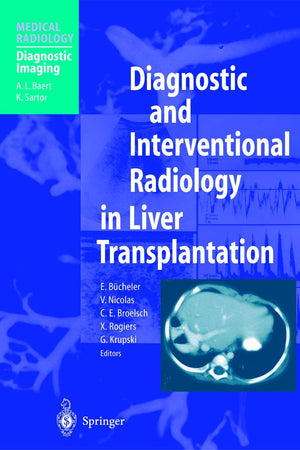 Diagnostic and Interventional Radiology in Liver Transplantation (Medical Radiology)