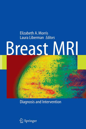 Breast MRI: Diagnosis and Intervention