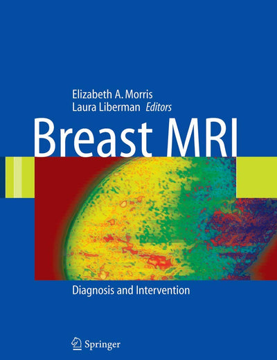 Breast MRI: Diagnosis and Intervention