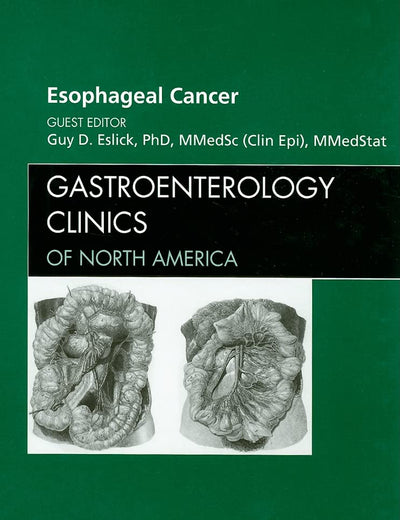 Esophageal Cancer, An Issue of Gastroenterology Clinics (Volume 38-1) (The Clinics: Internal Medicine, Volume 38-1)