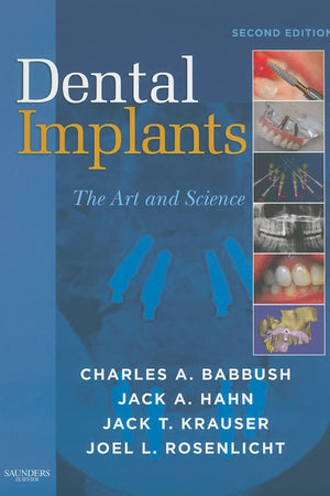 Dental Implants: The Art and Science