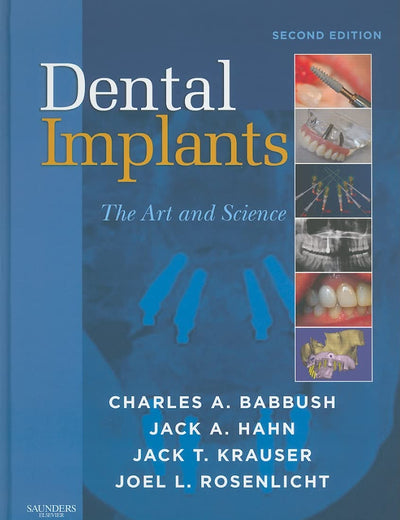 Dental Implants: The Art and Science