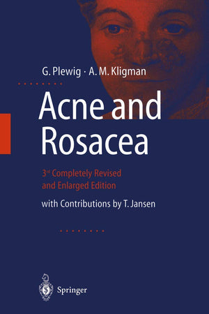 ACNE and ROSACEA