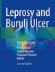 Leprosy and Buruli Ulcer: A Practical Guide